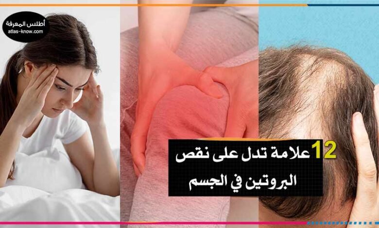 فقدان التركيز وضعف جذور الشعر وهشاشة العظام من علامات نقص البروتين في الجسم