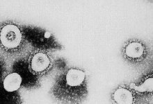 صورة فيروس كورونا