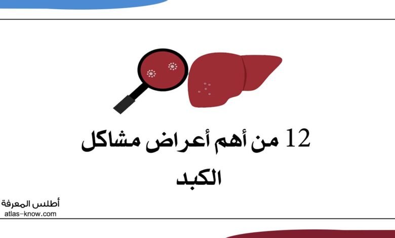 أعراض مشاكل الكبد
