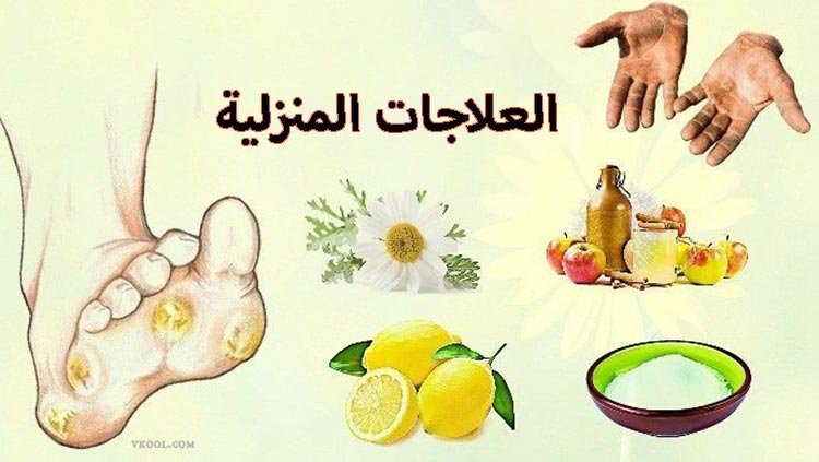 مسمار القدم أسبابه وعلاجه: يظهر الليمون وخل التفاح وقدم مصابة بمسمار لحمي، من أجل علاجه منزليا