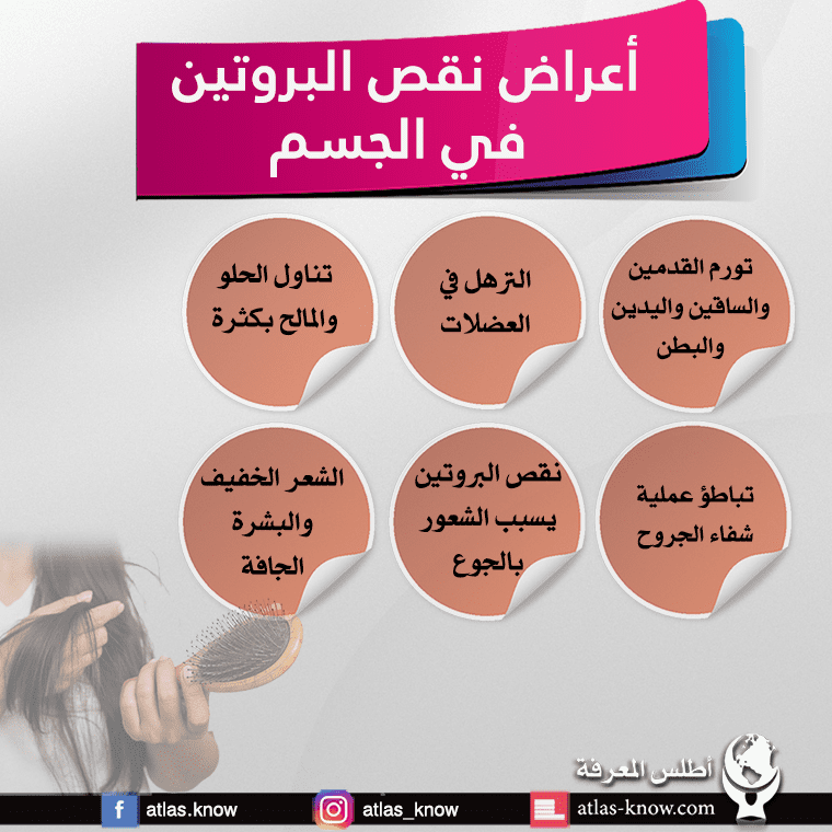 نقص البروتين في الجسم