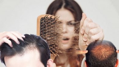 علاجات طبيعية لتساقط الشعر