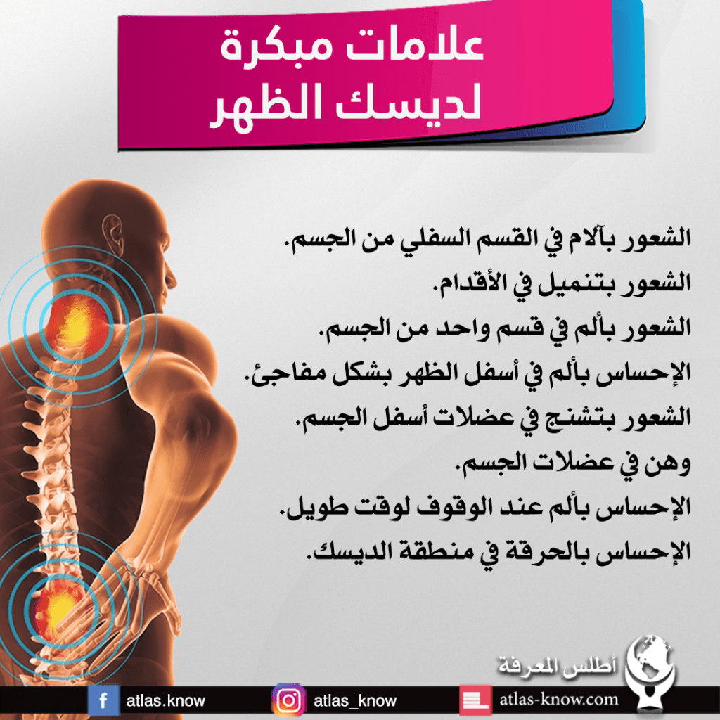 انفوجراف علامات مبكرة لديسك الظهر