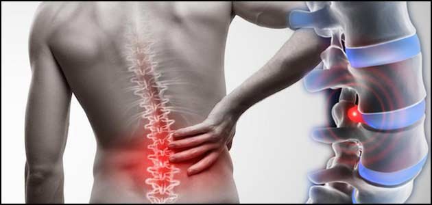 علامات مبكرة لديسك الظهر