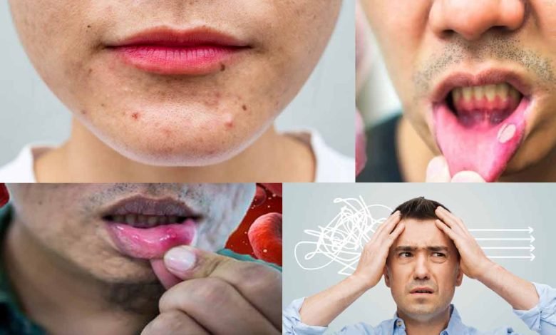 علامات نقص فيتامين B12 على الوجه