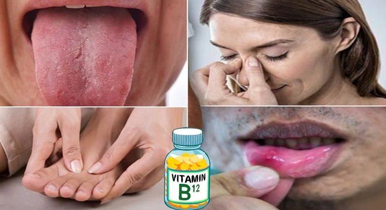 كيف نحدد نقص فيتامين b12